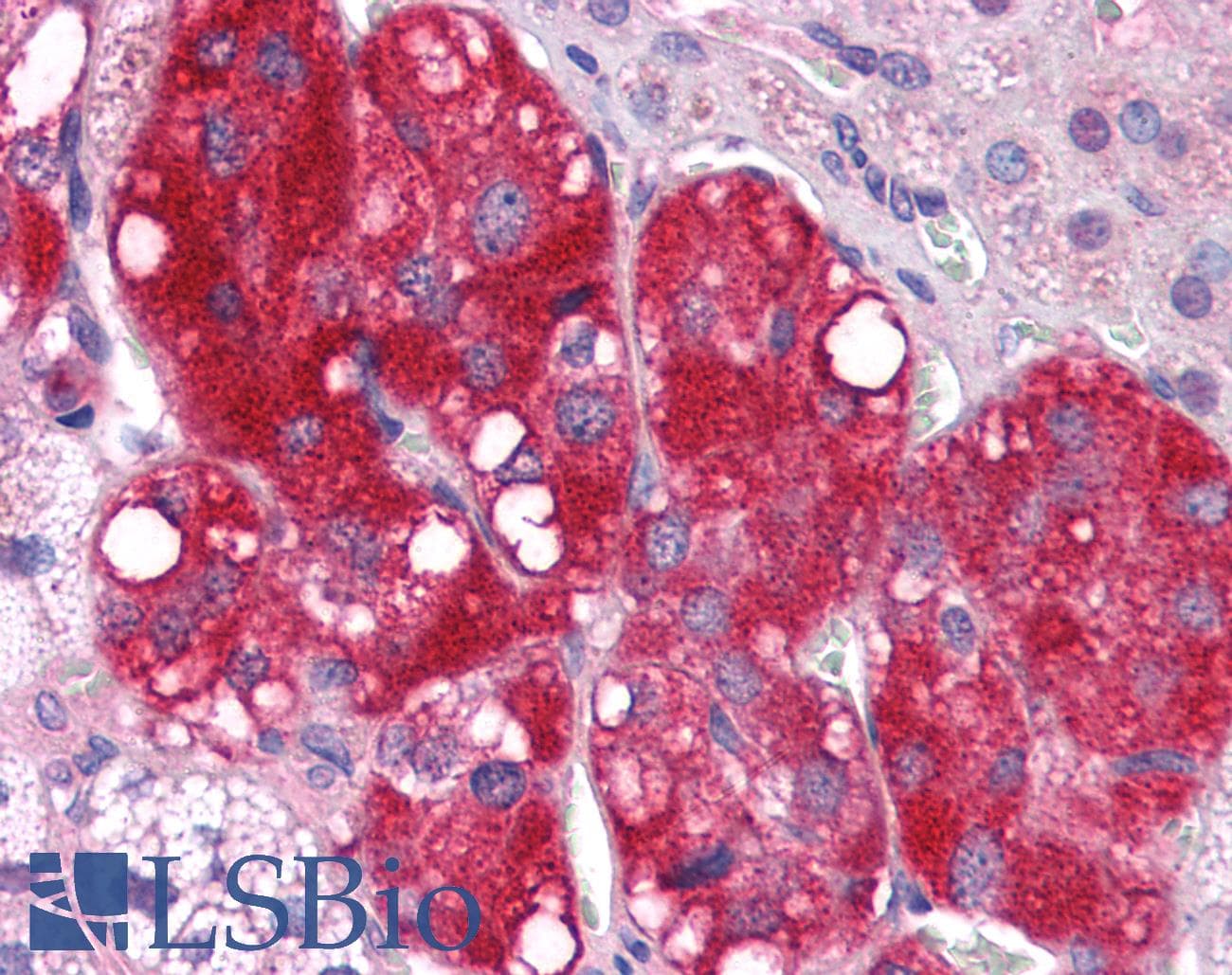 IHC-plus™ Polyclonal Rabbit anti-Human C4.4A / LYPD3 Antibody (C-Terminus, IHC)