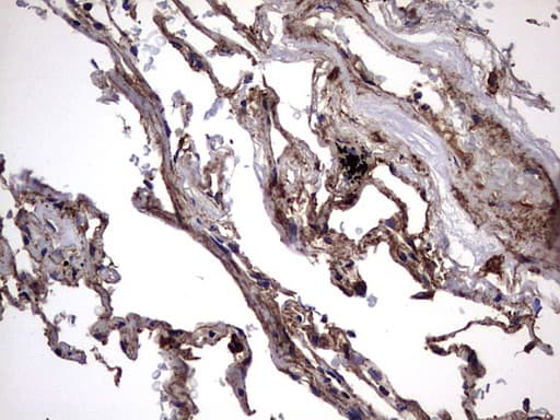 IL1RN Antibody (clone OTI2B1)