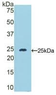 DSC1 / Desmocollin 1 Antibody (aa135-340)