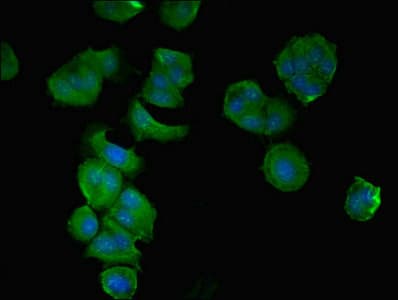 CCDC112 / MBC1 Antibody (Coiled-coil domain)