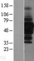HDAC1 Protein (Over-Expression Lysate Myc-DDK (Flag))