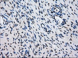 Monoclonal Mouse anti-Human L1CAM Antibody (clone OTI4F4, IHC, IF, WB)