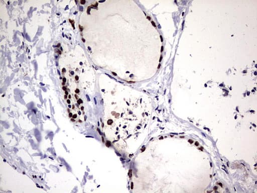 HNRPM / HNRNPM Antibody (aa1-261, clone OTI4C9)