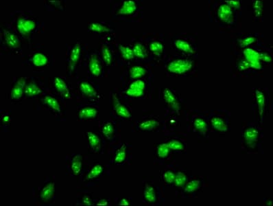 Polyclonal Rabbit anti-Human LYAR Antibody (IHC, WB)