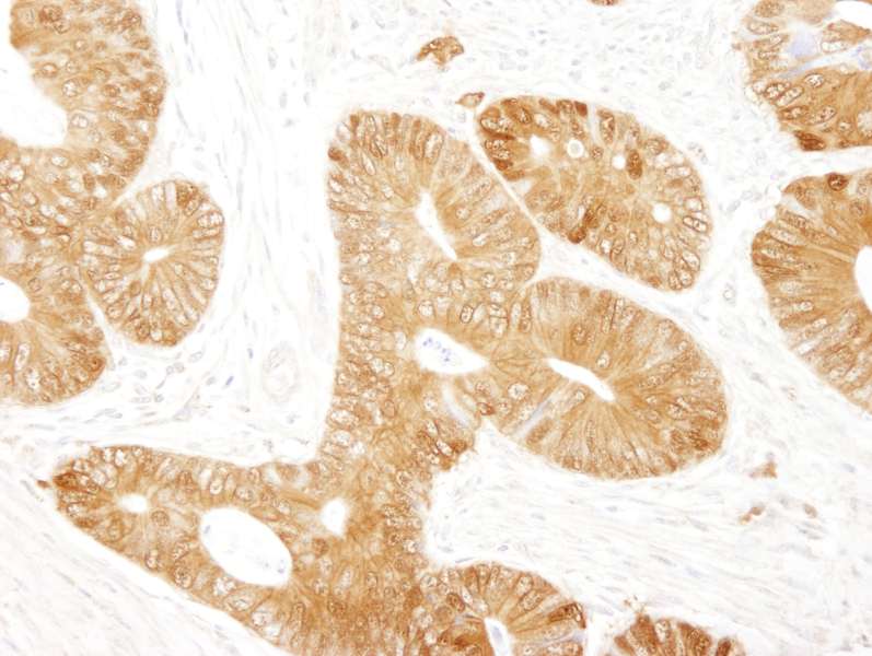 CTNNB1 / Beta Catenin Antibody (aa760-781)