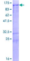 Human MARK2 Protein (Recombinant GST)