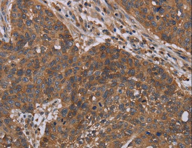 Polyclonal Rabbit anti-Human OXTR / Oxytocin Receptor Antibody (IHC)