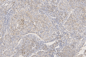 Polyclonal Rabbit anti-Human SFRP1 Antibody (IHC, WB)