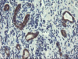 DPH2 Antibody (clone OTI3A12)