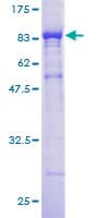 Human CORO1B Protein (Recombinant GST)