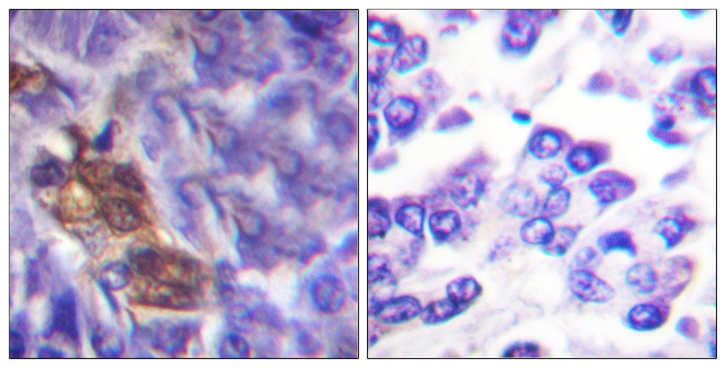RPS6KA5 / MSK1 Antibody (p360)