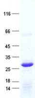 Human RPL10L Protein (Recombinant His, N-Terminal)