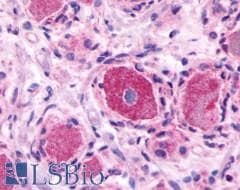 PathPlus™ Polyclonal Rabbit anti-Human MRGPRE / MRGE Antibody (C-Terminus, IHC)