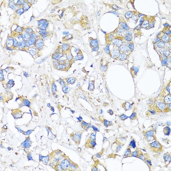 TIMP2 Antibody
