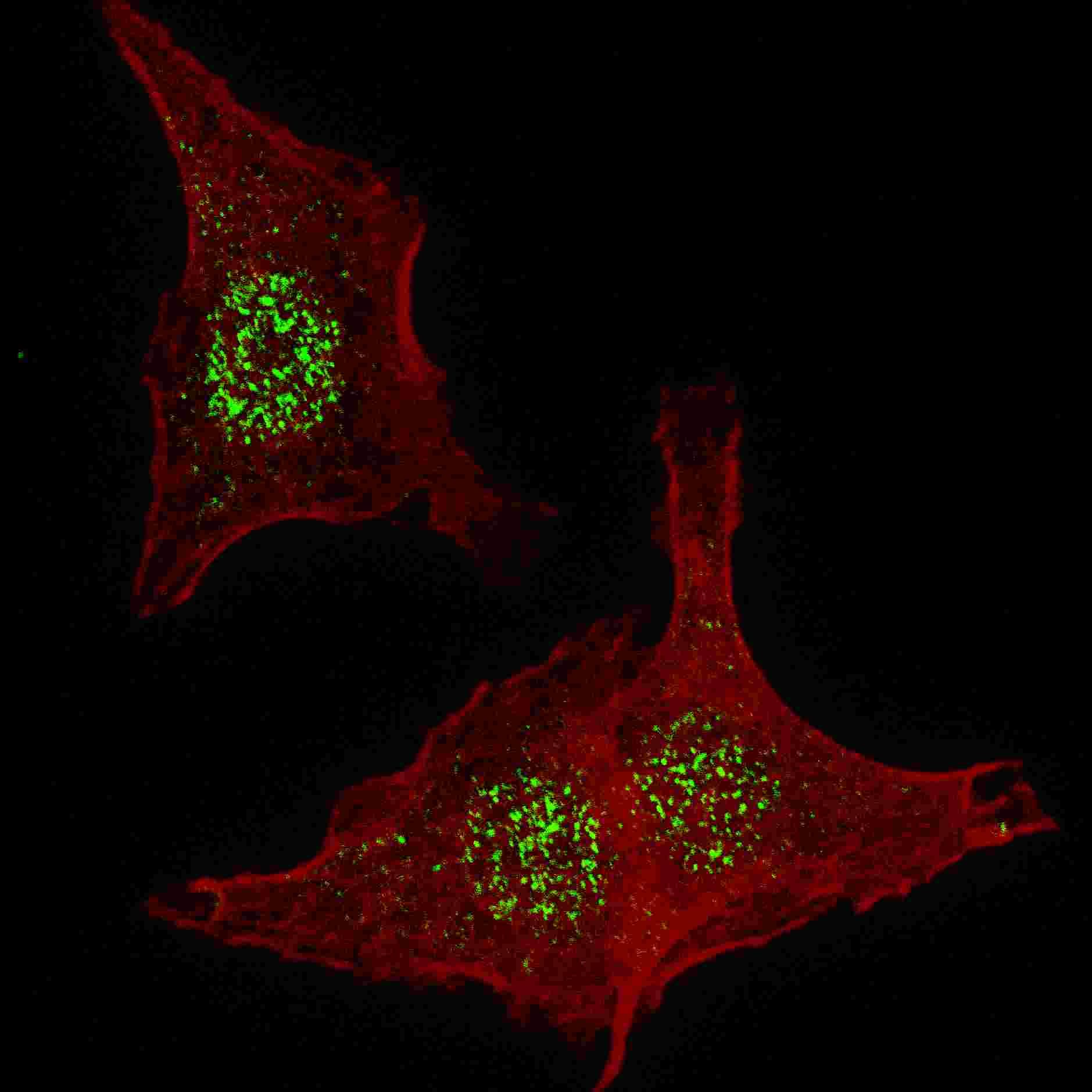 Polyclonal Rabbit anti-Human FGFR4 Antibody (aa24-55, IHC, IF, WB)