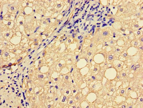 EPHA1 / EPH Receptor A1 Antibody