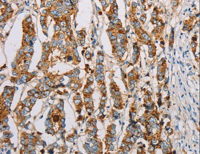 Fragilis / IFITM3 Antibody