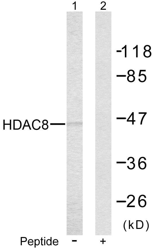 HDAC8 Antibody (p39)