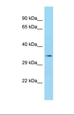 EPM2A / Laforin Antibody (aa78-127)