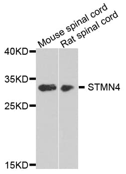 Polyclonal Rabbit anti-Human STMN4 / RB3 Antibody (WB)