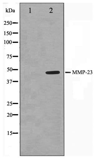 Polyclonal Rabbit anti-Human MMP23 Antibody (WB)