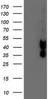 PDSS2 / DLP1 Antibody (clone OTI1C11)