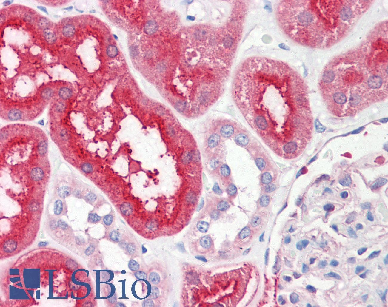 PathPlus™ SLC6A3 / Dopamine Transporter Antibody (EL2 Region)