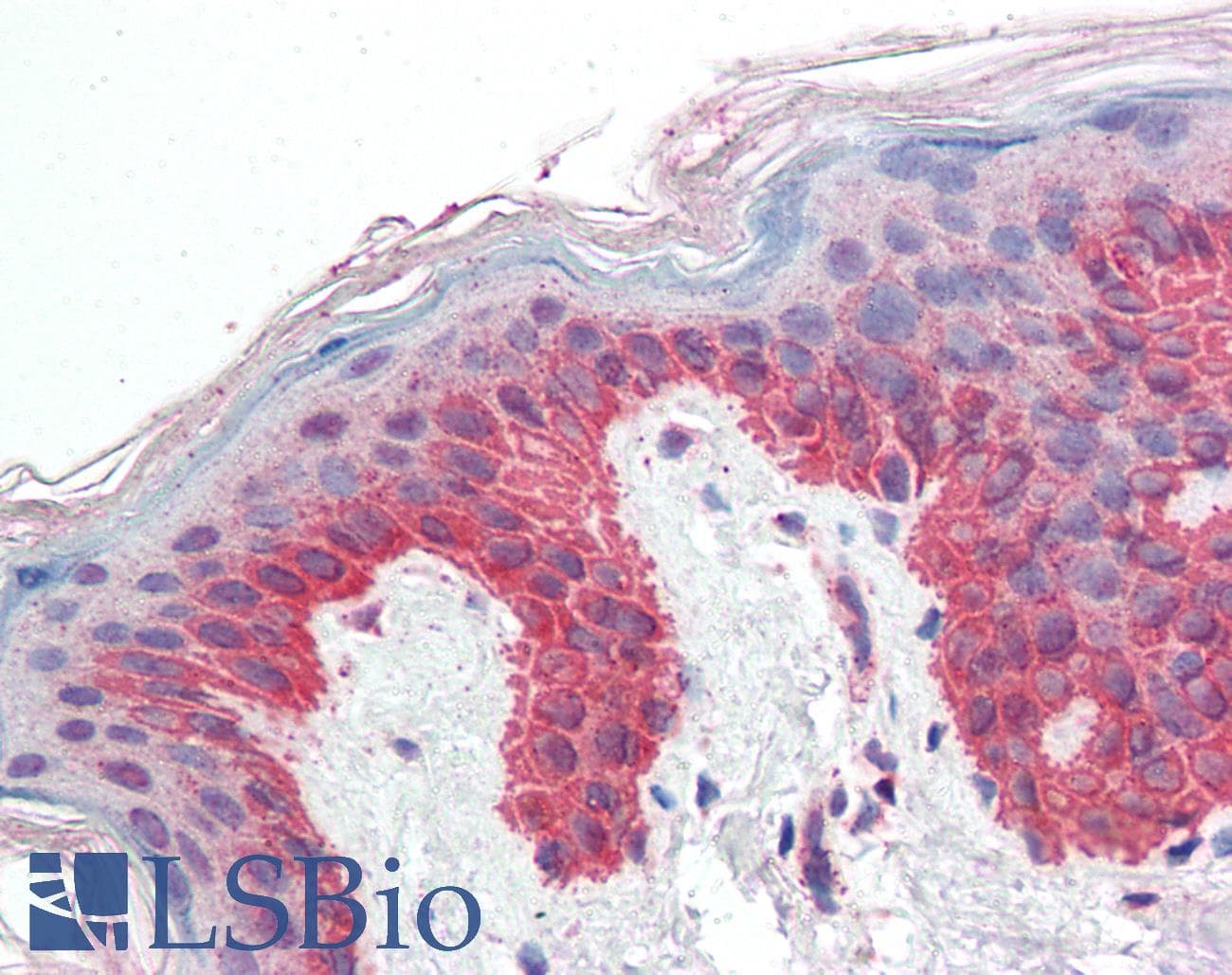 IHC-plus™ P4HA1 Antibody (aa431-443)