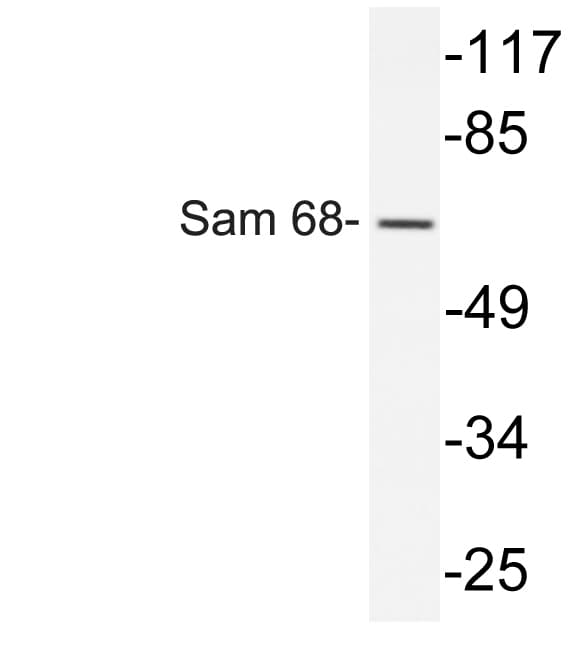KHDRBS1 / SAM68 Antibody (Tyr145)