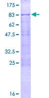 Human CDYL2 Protein (Recombinant GST)