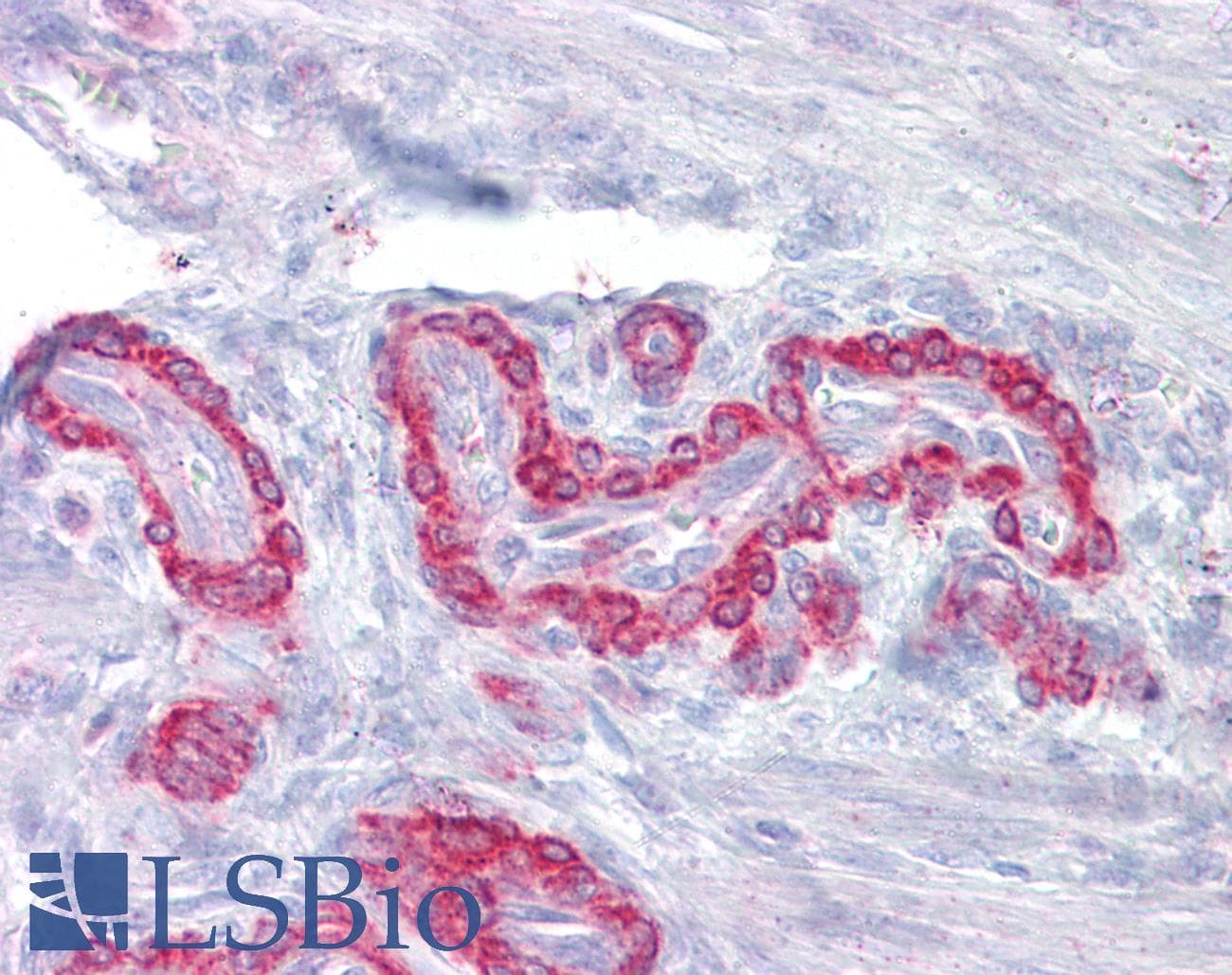 IHC-plus™ Polyclonal Rabbit anti-Human TM4SF1 Antibody (IHC, IF, WB)