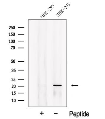 PLA2G12A Antibody