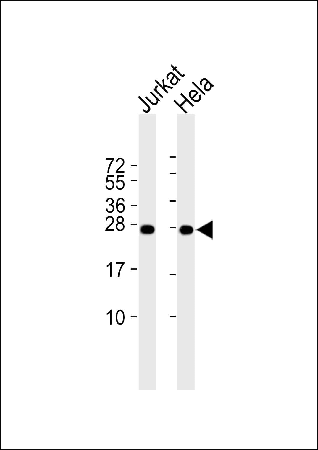 RPL10 / Ribosomal Protein L10 Antibody