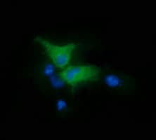 FAK / Focal Adhesion Kinase Antibody (clone OTI4D11)