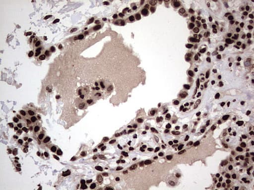 HNRNPL / hnRNP L Antibody (aa270-502, clone OTI2E4)