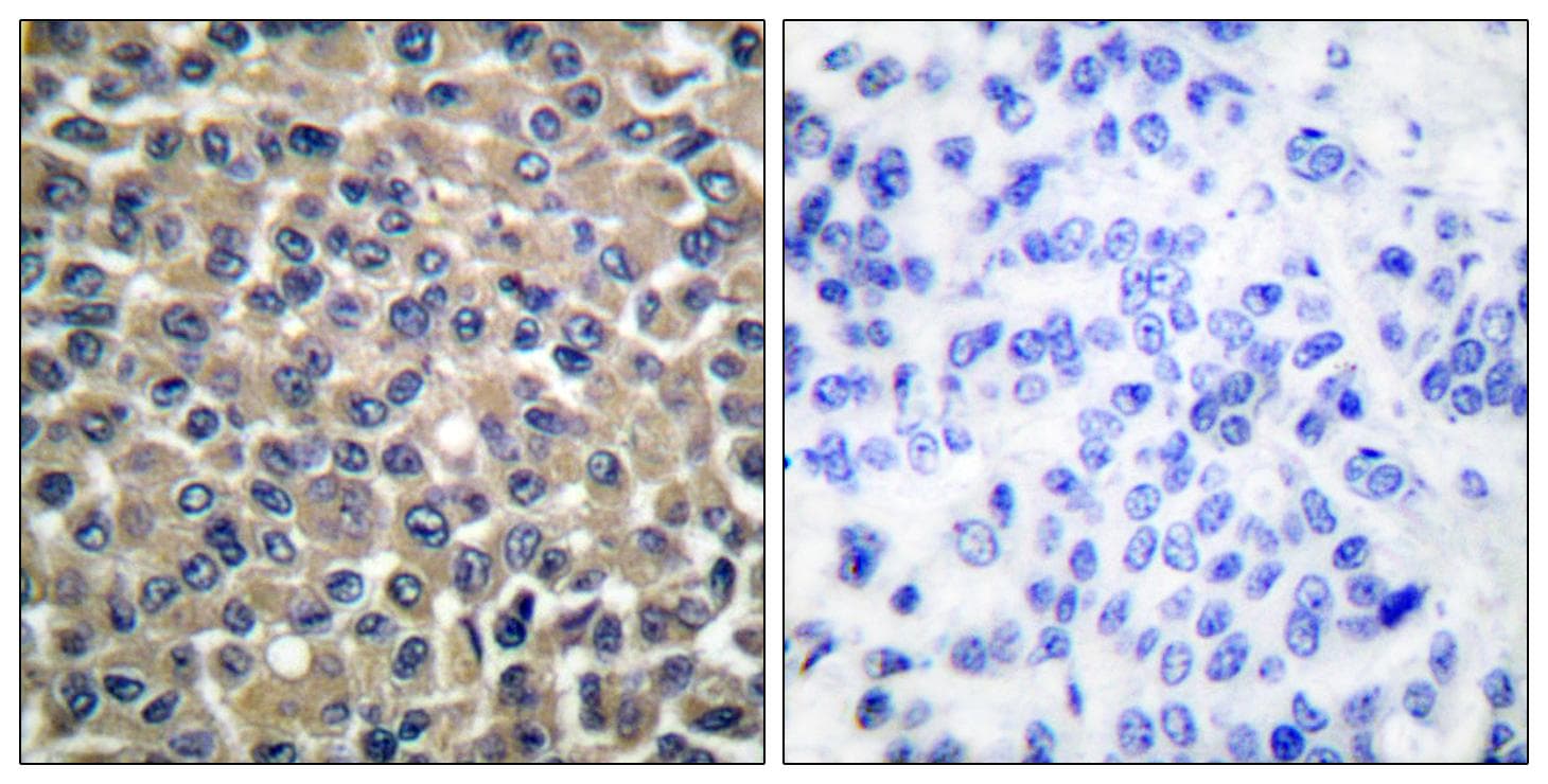 MMP19 Antibody