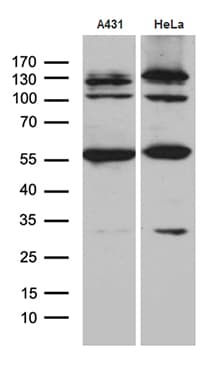 KLF5 / BTEB2 Antibody (aa1, clone OTI1E4)