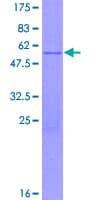 Human HSD17B8 / RING2 Protein (Recombinant GST)