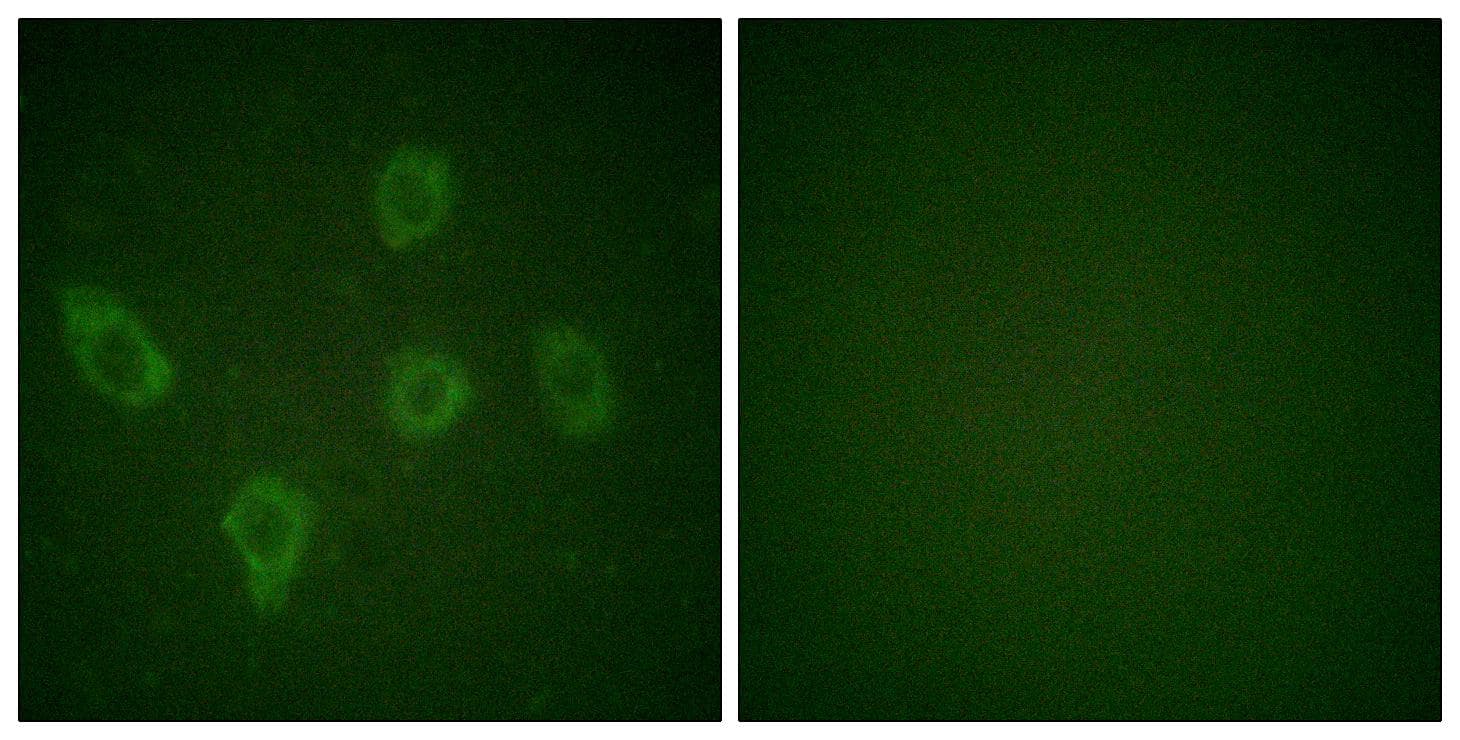 Polyclonal Rabbit anti-Human CASP9 / Caspase 9 Antibody (p125, IHC, IF, WB)