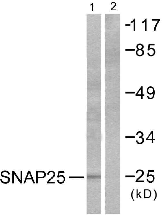 Polyclonal Rabbit anti-Human SNAP25 Antibody (IHC, WB)