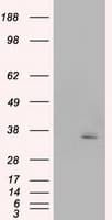 Monoclonal Mouse anti-Human PIM2 / Pim-2 Antibody (clone OTI8B4, IHC, IF, WB)
