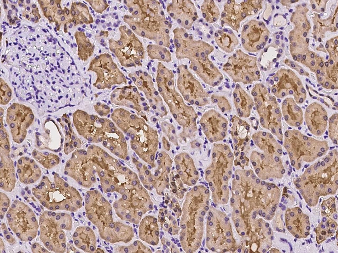 ST6GAL2 Antibody