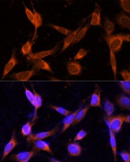 Polyclonal Rabbit anti-Human TMEM49 Antibody (IF)