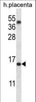 TM4SF18 Antibody (aa113-141)