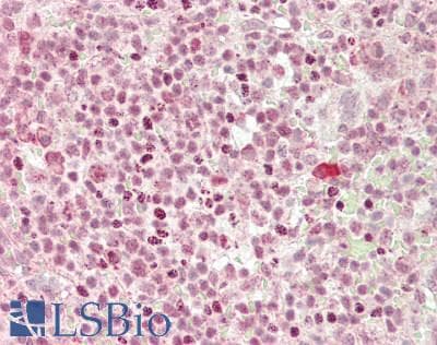 MIP2 / GRO2 / CXCL2 Antibody (aa34-107)