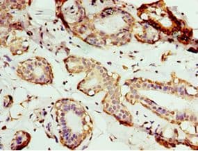 AP1M2 Antibody (aa164-423)