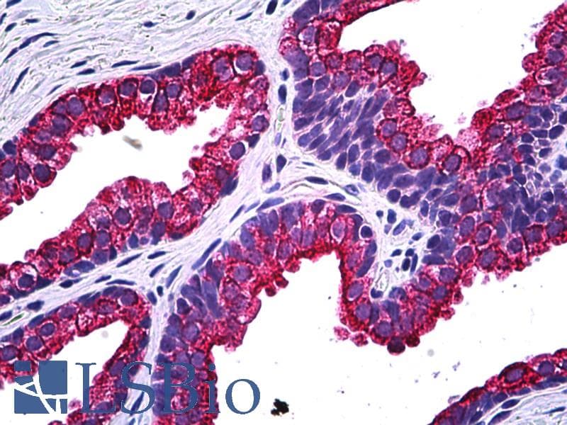 IHC-plus™ Monoclonal Mouse anti-Human NPRB / NPR2 Antibody (clone 2A6, IHC, WB)