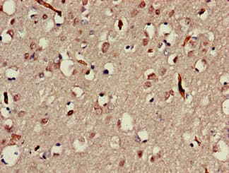 MAP3K13 / LZK Antibody