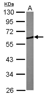 Polyclonal Rabbit anti-Human CORO1B Antibody (aa1-213, IHC, WB)