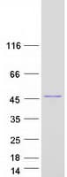 Human BCS1L Protein (Recombinant Myc-DDK (Flag))